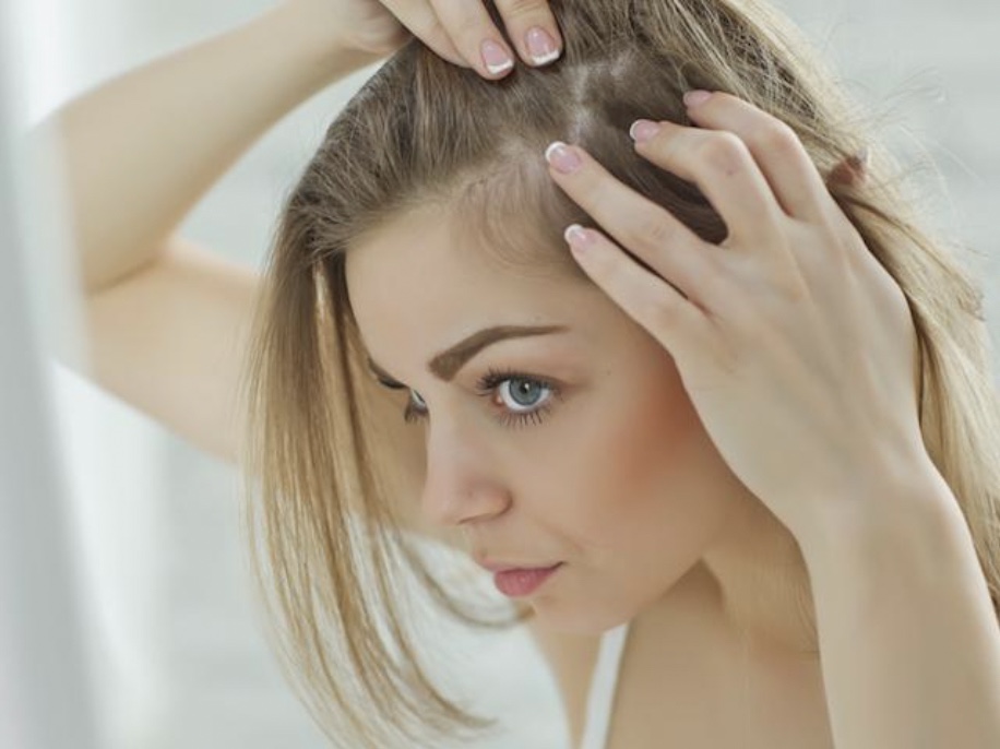 Best Supplements for Hair Thinning and Hair Loss